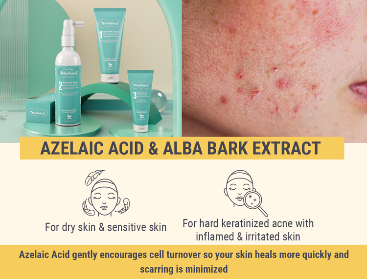 Acne Face Care With Azelaic Acid & Salix Alba Bark Extract - Who Is It For