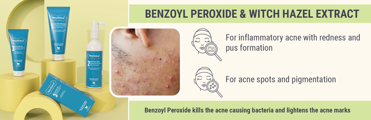 Acne Face Care With Benzoyl Peroxide & Witch Hazel Extract - Who Is It For