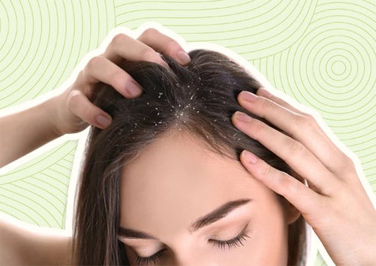 The Teenage Guide to Dandruff-Free Hair: What to Avoid in Hair Care Products
