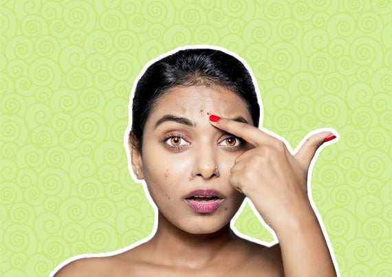 Uncovering Hidden Culprits: Why Your Acne Persists Despite a Skincare Routine