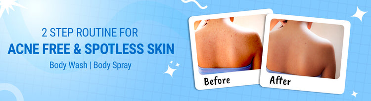 Teenilicious Body Acne Care